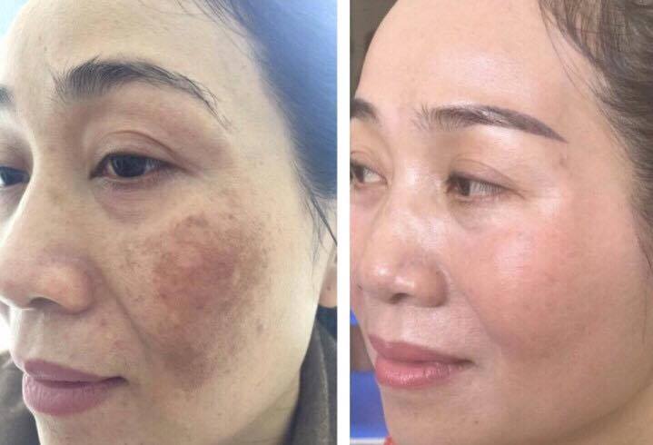 MD DERMATICS CHI NHÁNH TẠI ĐÀ NẴNG ✦ Địa chỉ:32 Pastuer, Hải Châu, TP Đà Nẵng ✦ Hotline: 0935 24 99 35 - 0935 350 419 Fanpage: https://www.facebook.com/MDdermaticsDanang/