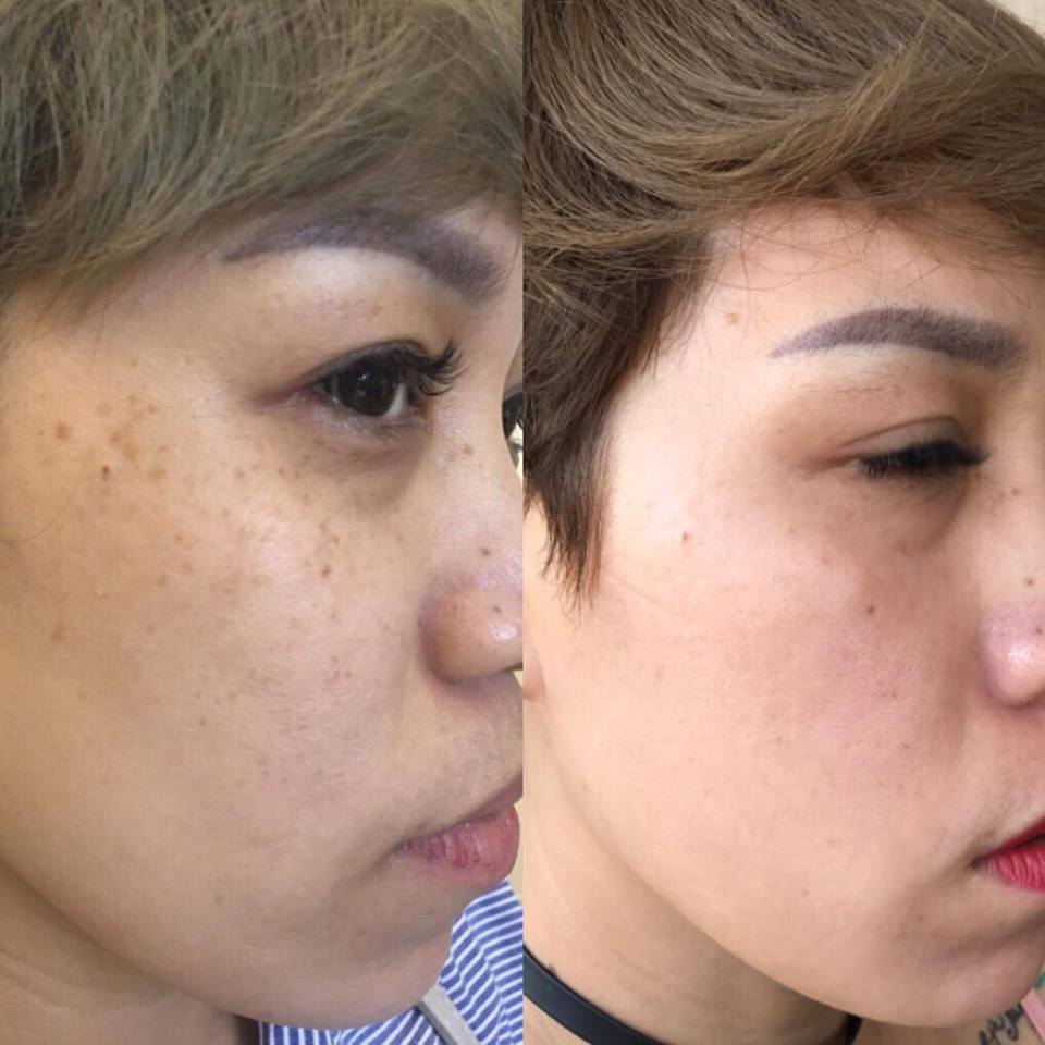 MD DERMATICS CHI NHÁNH TẠI ĐÀ NẴNG ✦ Địa chỉ:32 Pastuer, Hải Châu, TP Đà Nẵng ✦ Hotline: 0935 24 99 35 - 0935 350 419 Fanpage: https://www.facebook.com/MDdermaticsDanang/